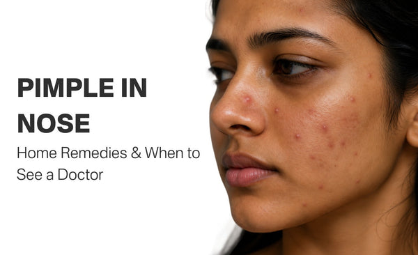 Pimple in Nose: Home Remedies & When to See a Doctor