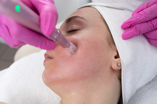Pimple Scar Removal: Best Treatments That Work