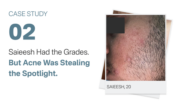Saieesh Had the Grades. But Acne Was Stealing the Spotlight.