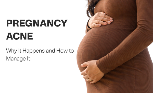 Pregnancy Acne: Why It Happens and How to Manage It