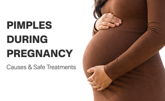 Pimples During Pregnancy: Causes & Safe Treatments