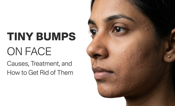 Tiny Bumps on Face: Causes, Treatment, and How to Get Rid of Them
