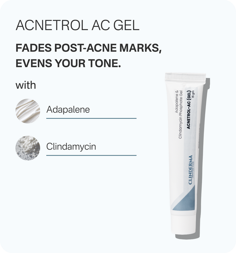 Anti-Acne Kit – Gut Reset
