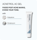 Anti-Acne Kit – Calm
